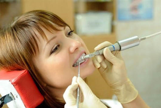 восстановление эмали зубов у стоматолога