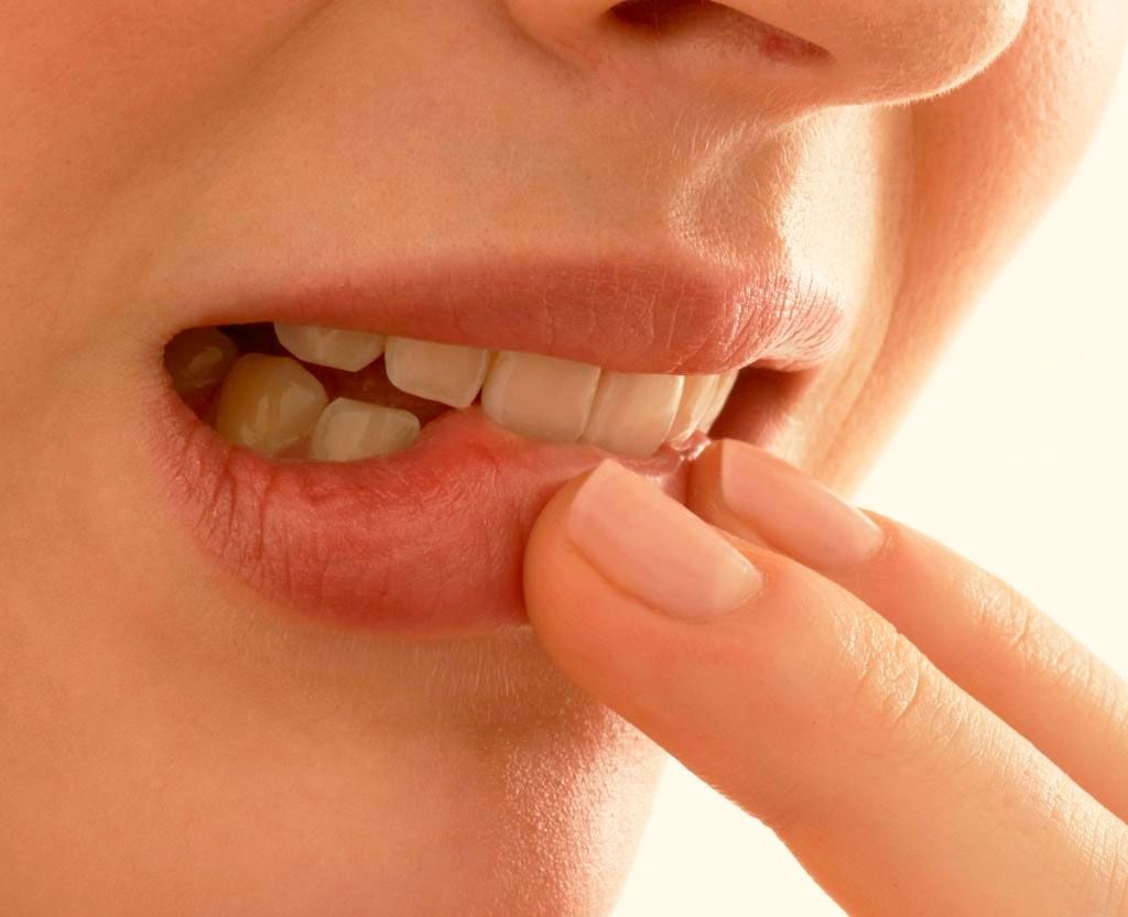 Вопросы по восстановлению зубов