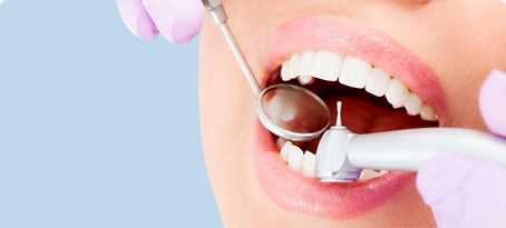 Восстановление зубов, установка пломб